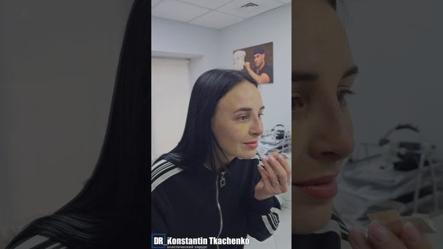 Первое впечатление после риносептопластики.