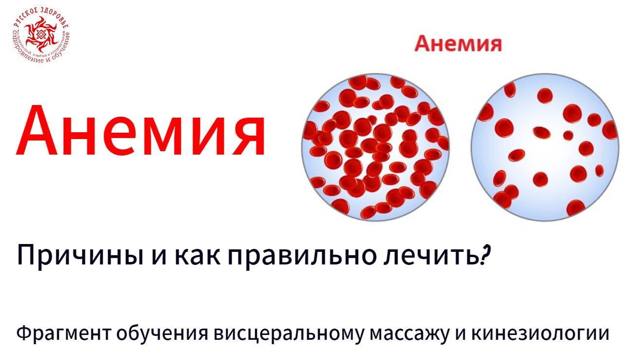 Анемия. Причины и как правильно лечить? Фрагмент обучения висцеральному массажу и кинезиологии