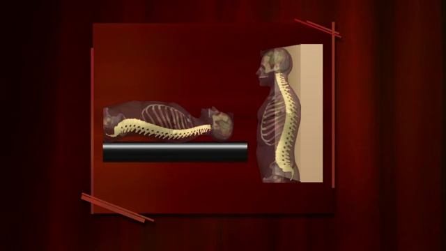 7833-04 - Head and Neck Posture - How to Sing