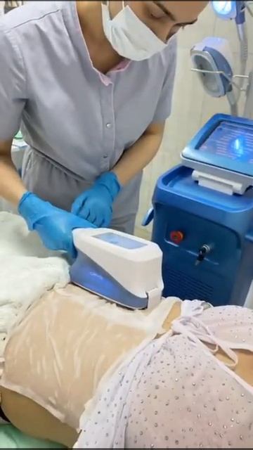 Процедура криолиполиз