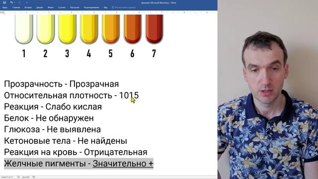Общий анализ мочи (ОАМ) - желтуха 2. Консультация к экзамену.