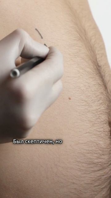 Препараты для похудения. Как безопасно и эффективно сбросить вес?