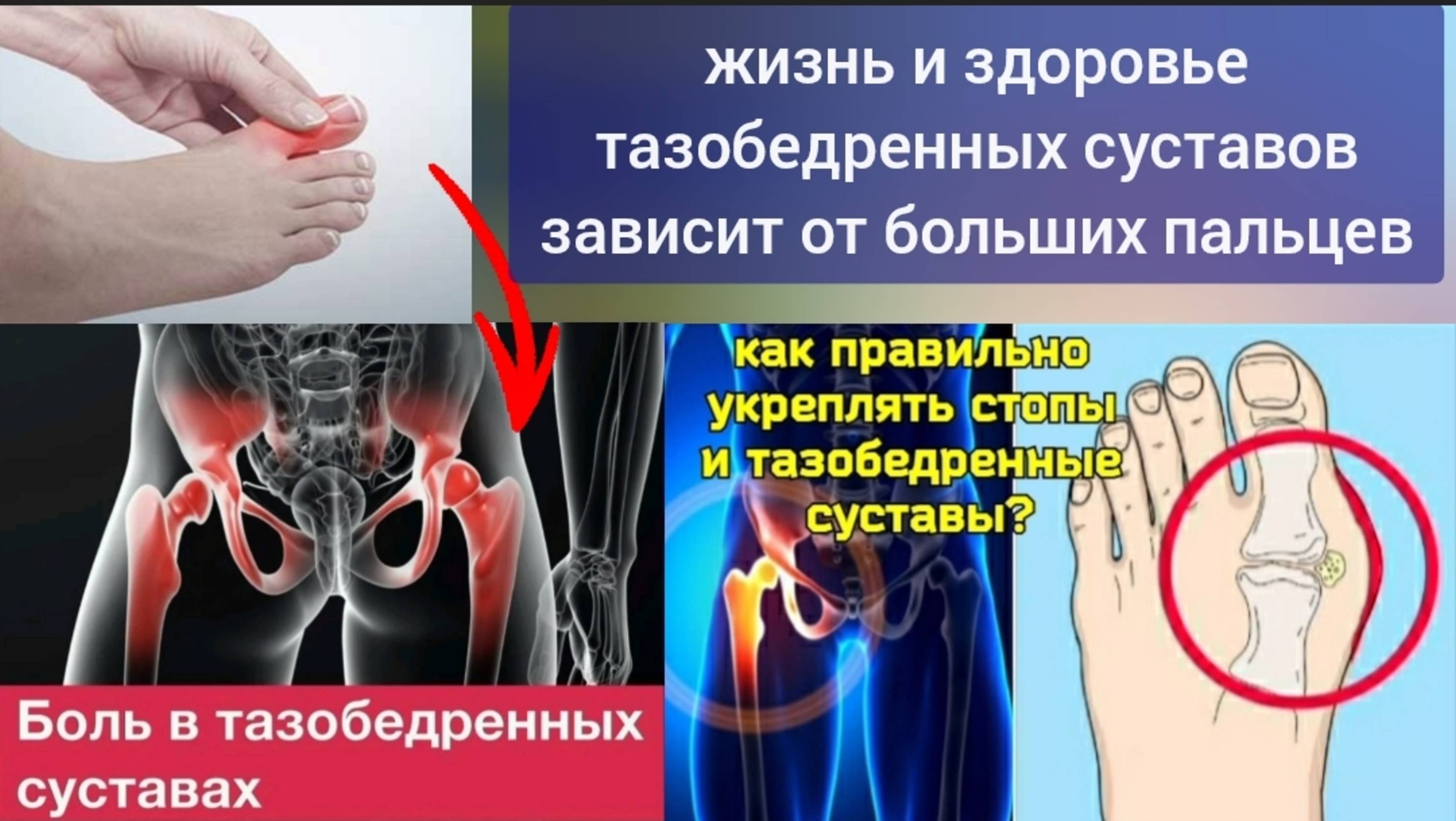 Как большой палец губит тазобедренный сустав при ходьбе? Упражнение "большепальцевый замок"