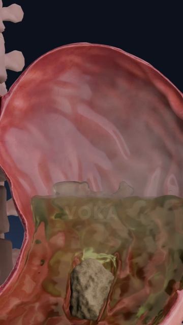 Визуализация вздутия живота в 3D: что происходит в вашем теле?