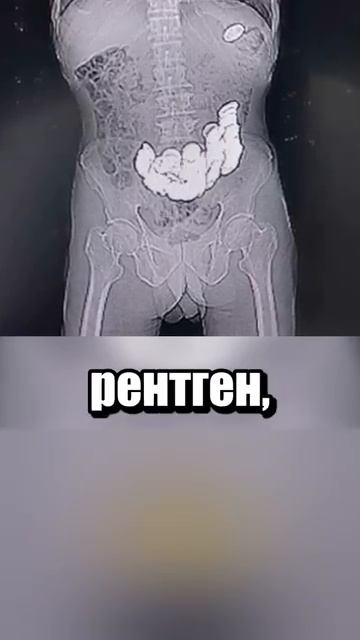 i11ushenka (302)
