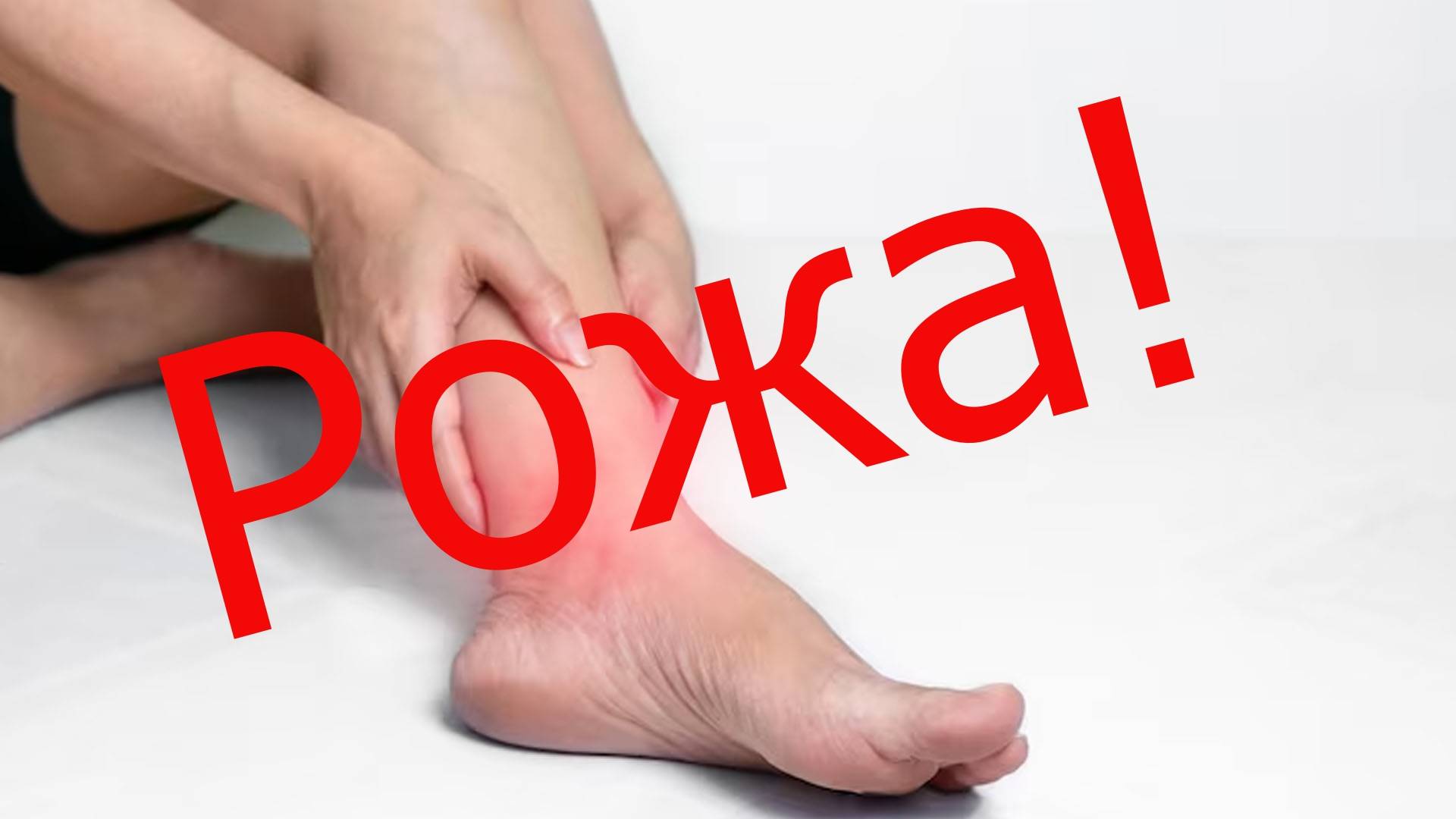 Рожистое воспаление на голени!