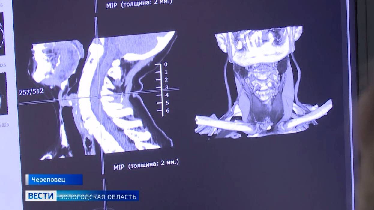 Проходить рентгенологические исследования вологодским пациентам становится проще и быстрее