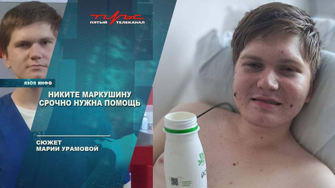 Никите Маркушину срочно нужна помощь