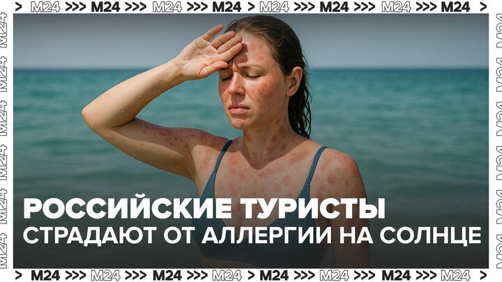 Аллергия на солнце испортила отдых сотен россиян в Анталье - Москва 24