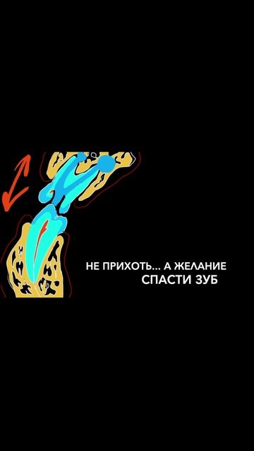 Неотвратимость процесса разрушения зубов, как закат и восход солнца #стоматология #спб #shorts