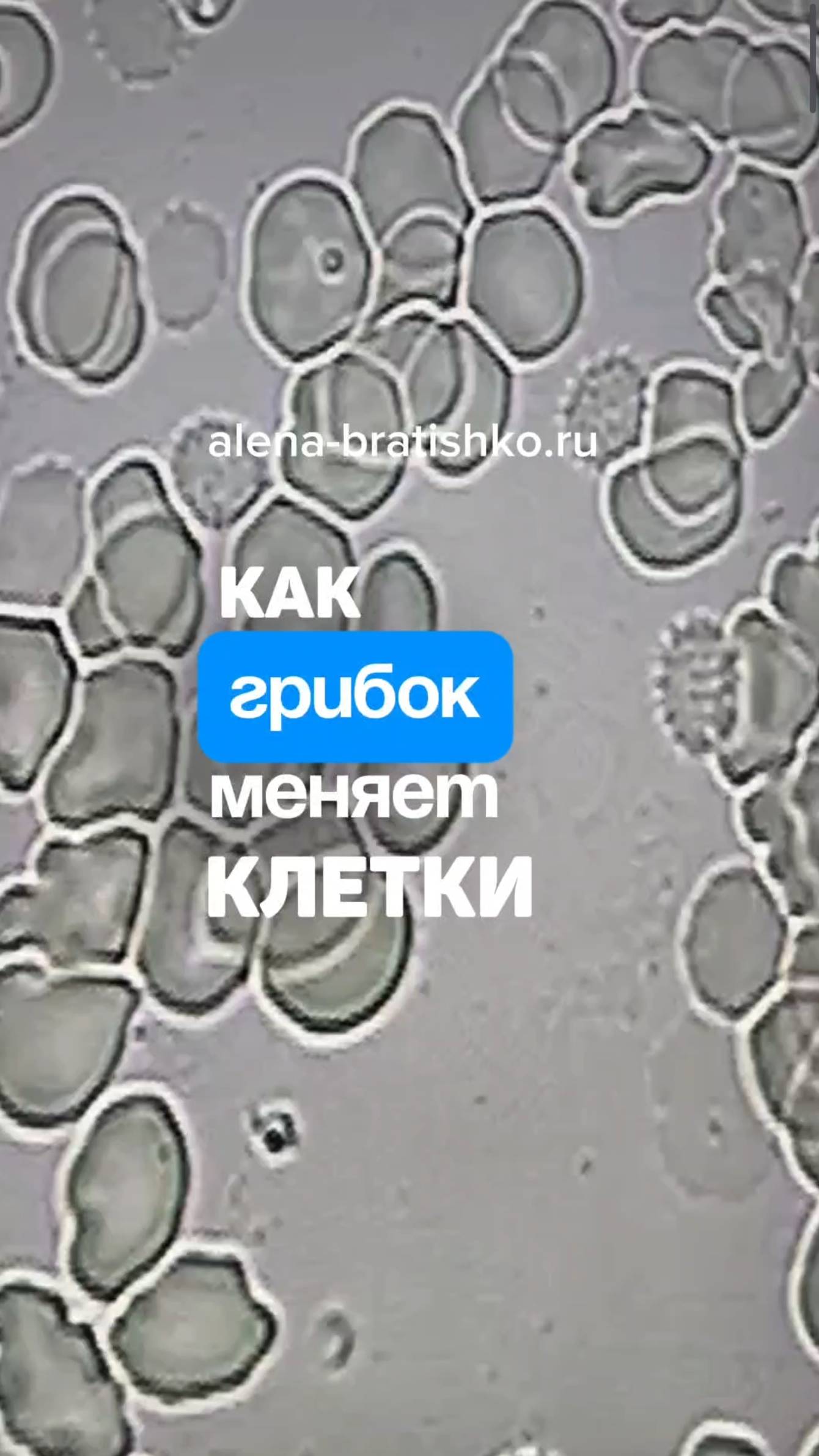 Как грибок (кандида) портит клетки. Семейный доктор Алена Братишко