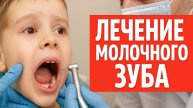 Лечение молочных зубов