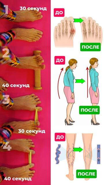 Избавляемся от вальгуса. Подпишись и читай описание ✅