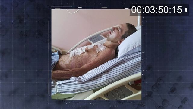 Военная комбустиология
