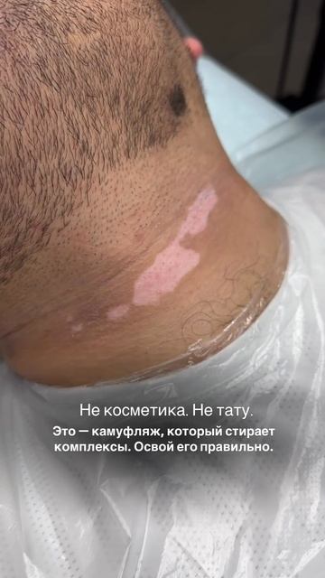 Не косметика. Не тату. Это камуфляж, который стирает комплексы. Освой это правильно