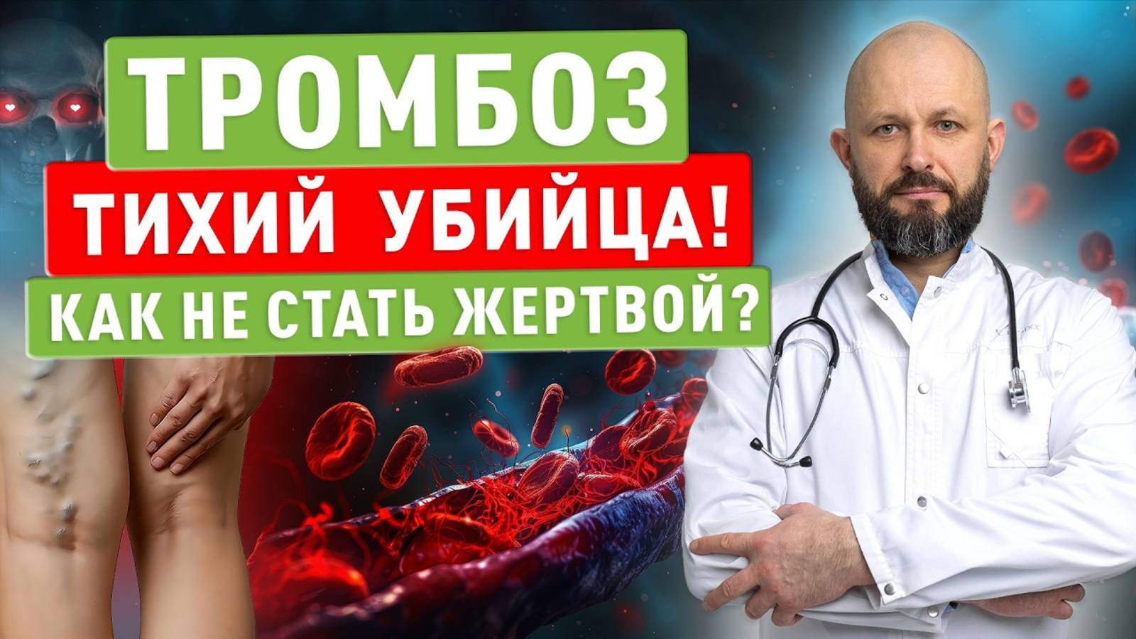 Тромбоз – тихий убийца! Как не стать жертвой