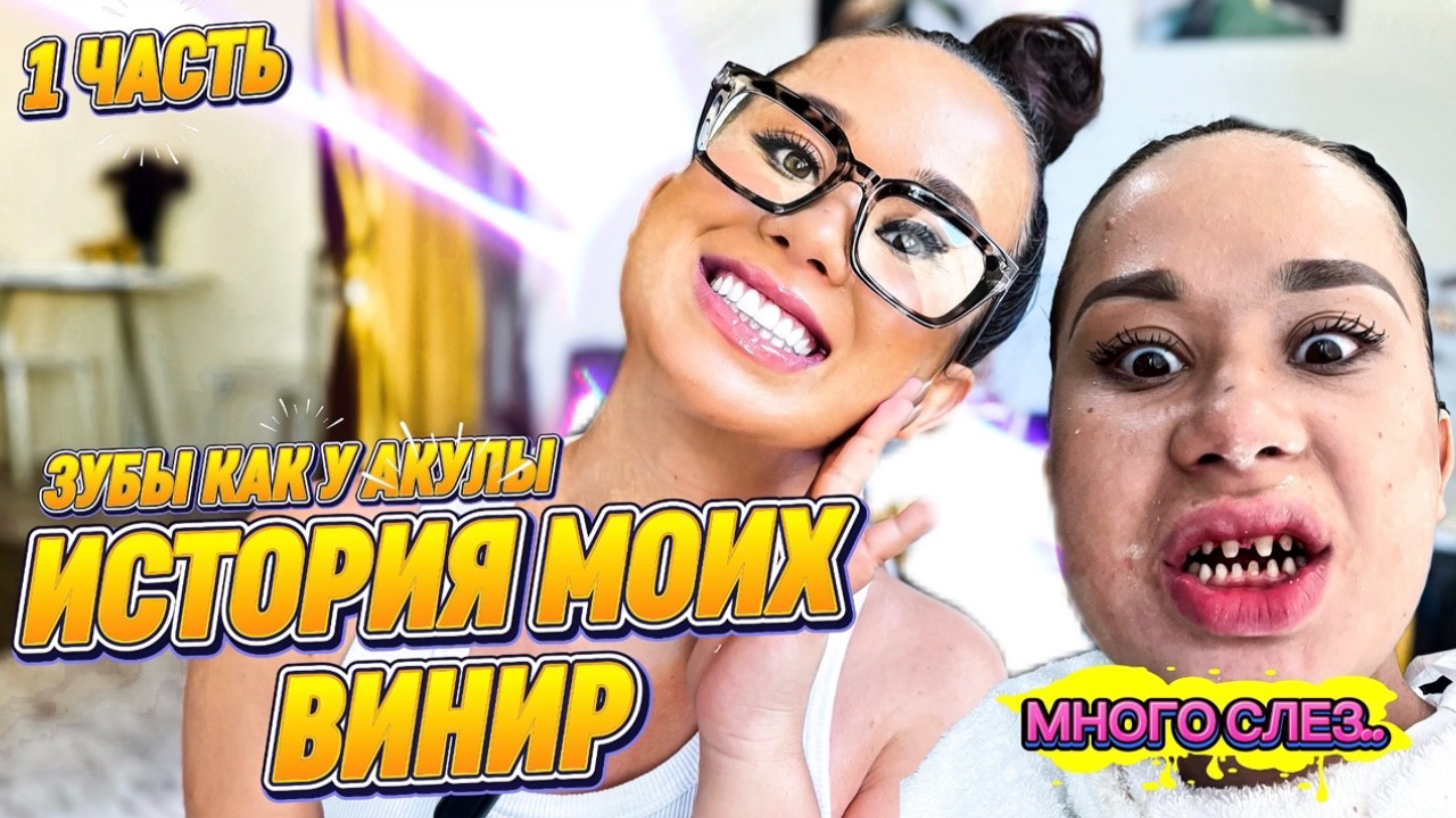 ЖЕСТКАЯ ИСТОРИЯ МОИХ ВИНИР: Зубы как у акулы и много слез..🙄💔
