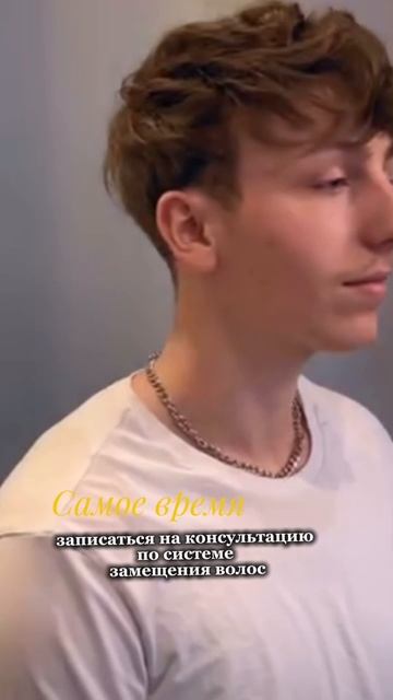 Система волос