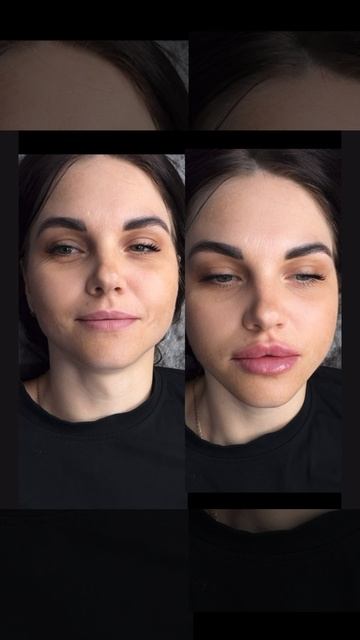КП