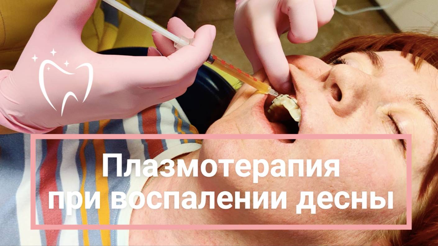 💉Плазмотерапия (плазмолифтинг)  десен
