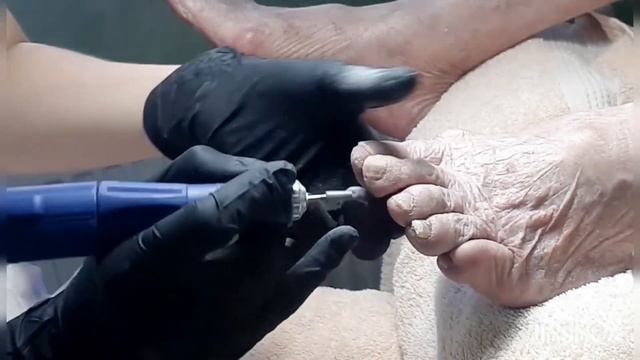 Педикюр.Ноги пожилого человека