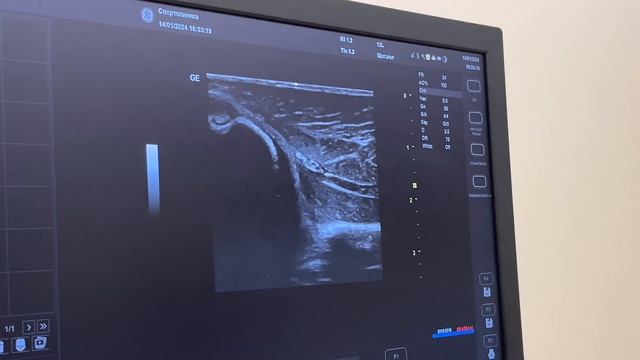 КУРС РЕГИОНАРНАЯ АНЕСТЕЗИЯ