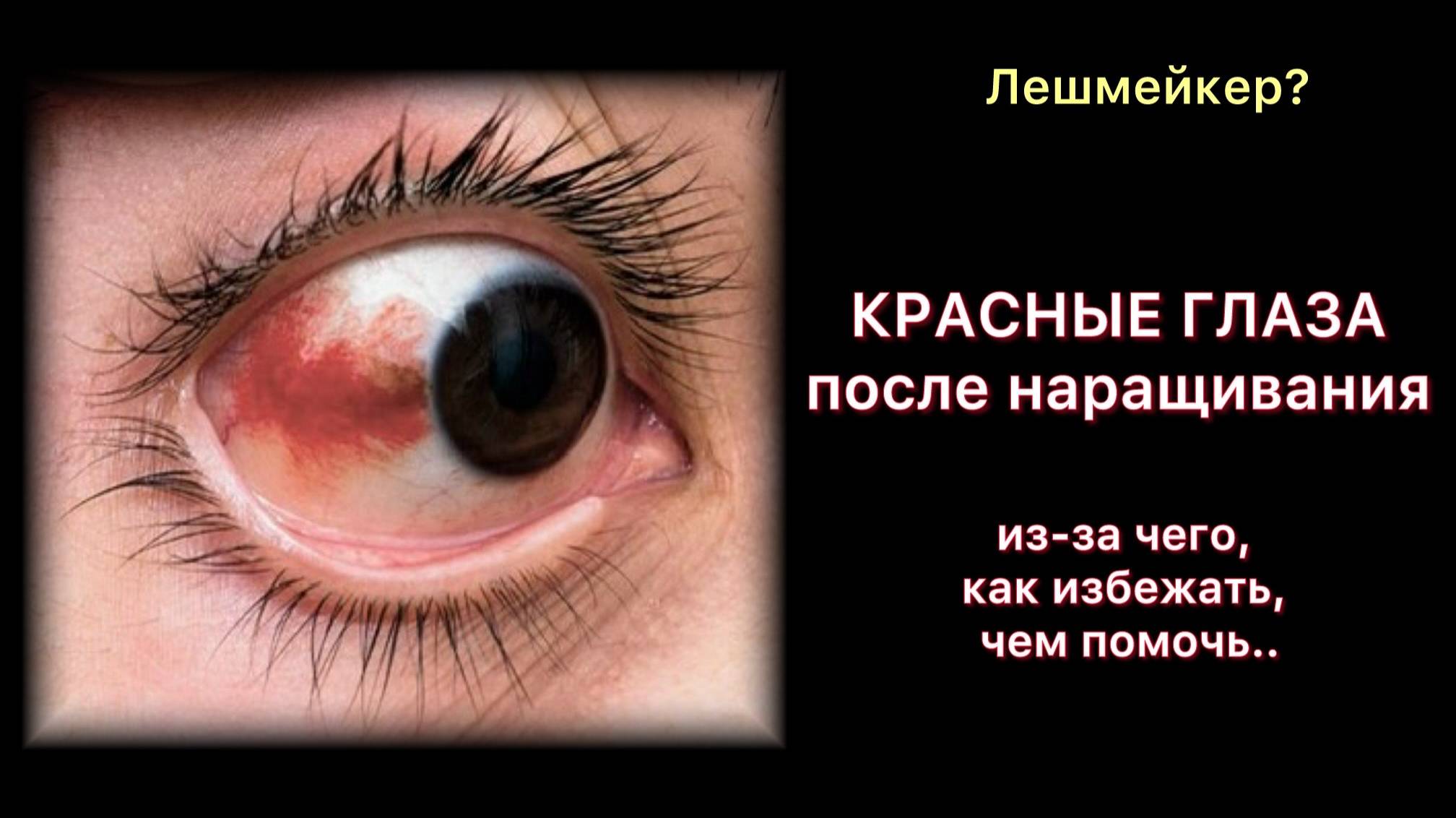 Из-за чего? Как избежать? Как исправить?