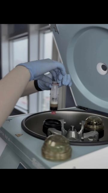 PRP-терапия — ваш союзник в эффективной пересадке волос 💉