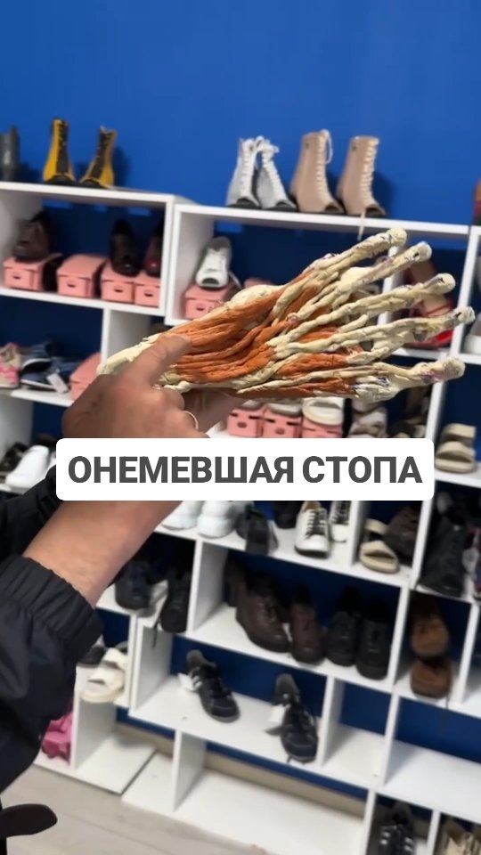 Почему немеет стопа. Присылайте нам фото ног, проконсультируем, дадим последовательность действий
