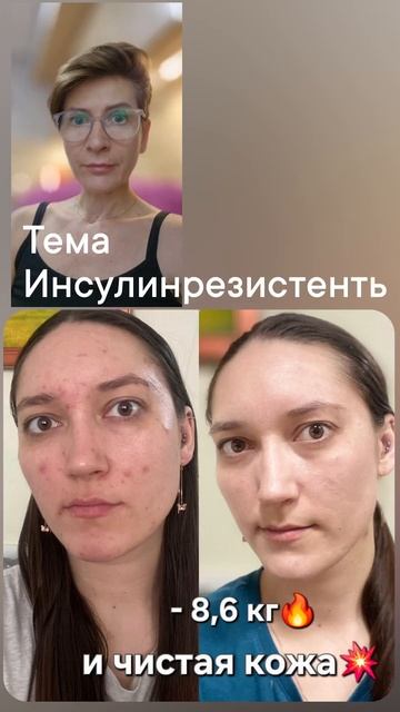 инсулинрезистентность