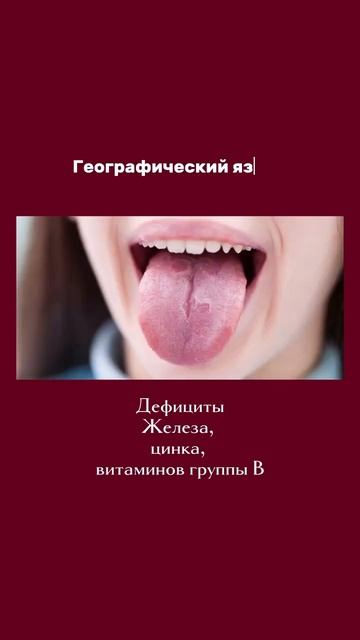 Вот, как НА САМОМ ДЕЛЕ выглядят ✨ДЕФИЦИТЫ✨