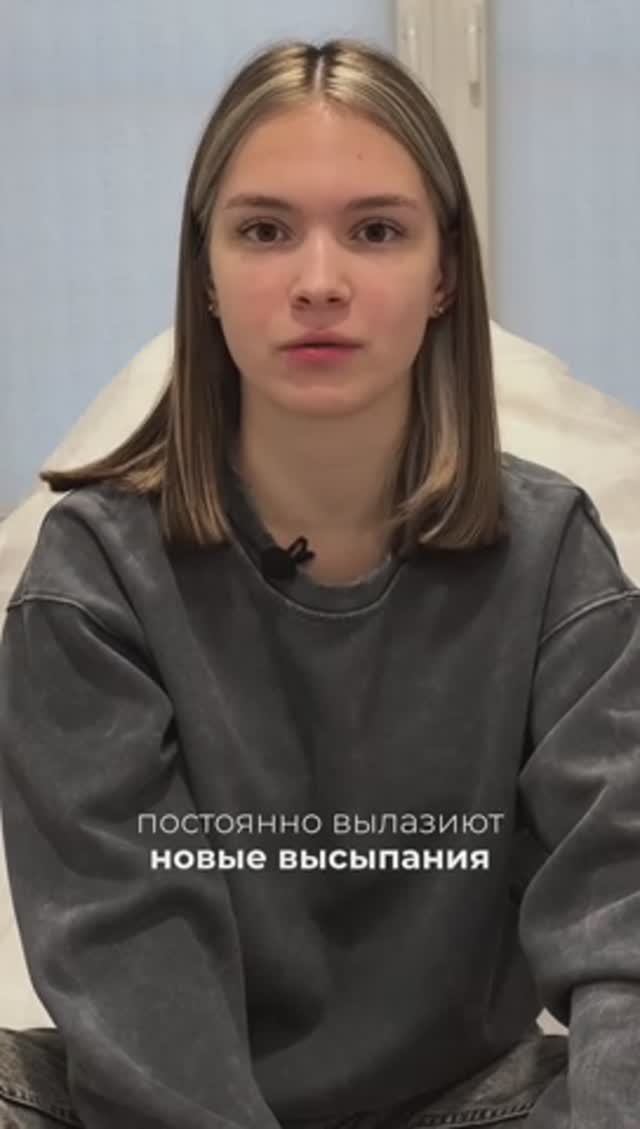 Получилось как и планировали! Результат лечения акне и  отзыв пациента | Эстетик Клаб |