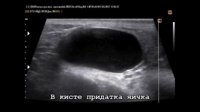 Акустический поток