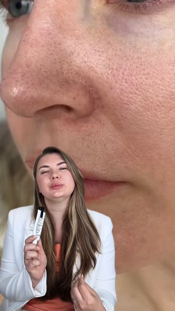 Расширенные поры