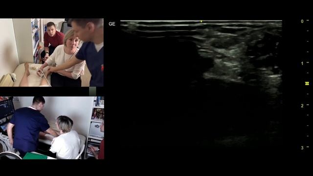 КУРС УЗИ-НАВИГАЦИЯ В РЕГИОНАРНОЙ АНЕСТЕЗИИ
#курсыузи #узинавигация