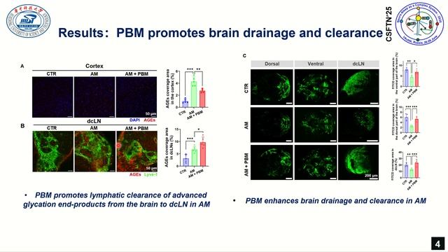 Photobiomodularion enhanxes meningeal brain drainage to mitigate aging-related neurolog