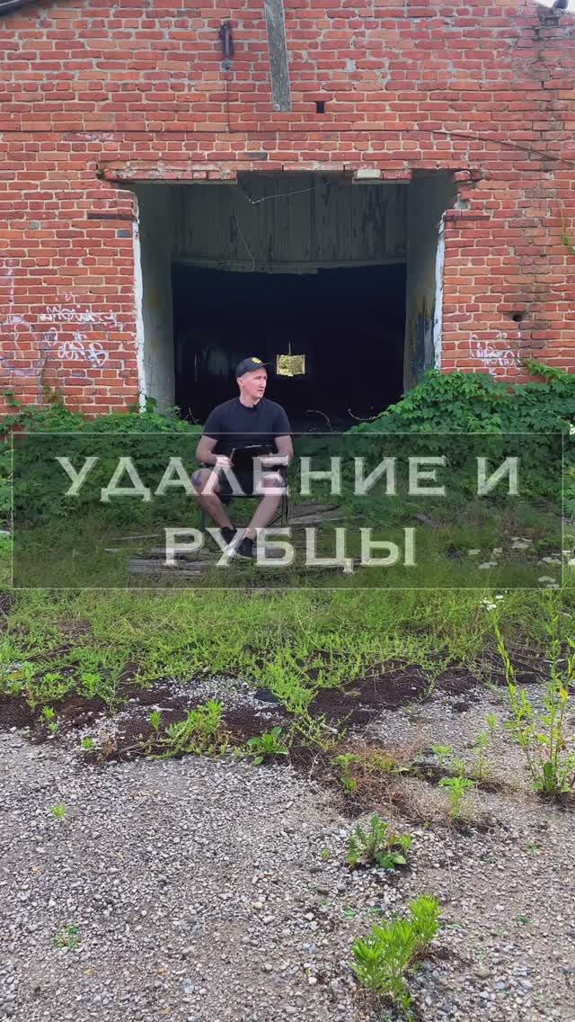 Удаление тату и рубцы ?
