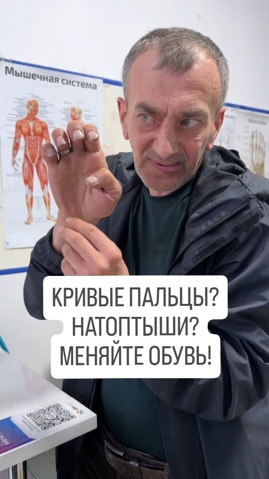 Почему пальцы искривились и стали молоткообразными?  #плоскостопие #кривыепальцы #натоптыши #вальгус