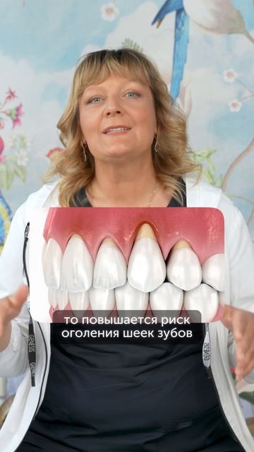 Почему наклон зубов влияет на здоровье десен #еленавитальевнатерентьева #десна