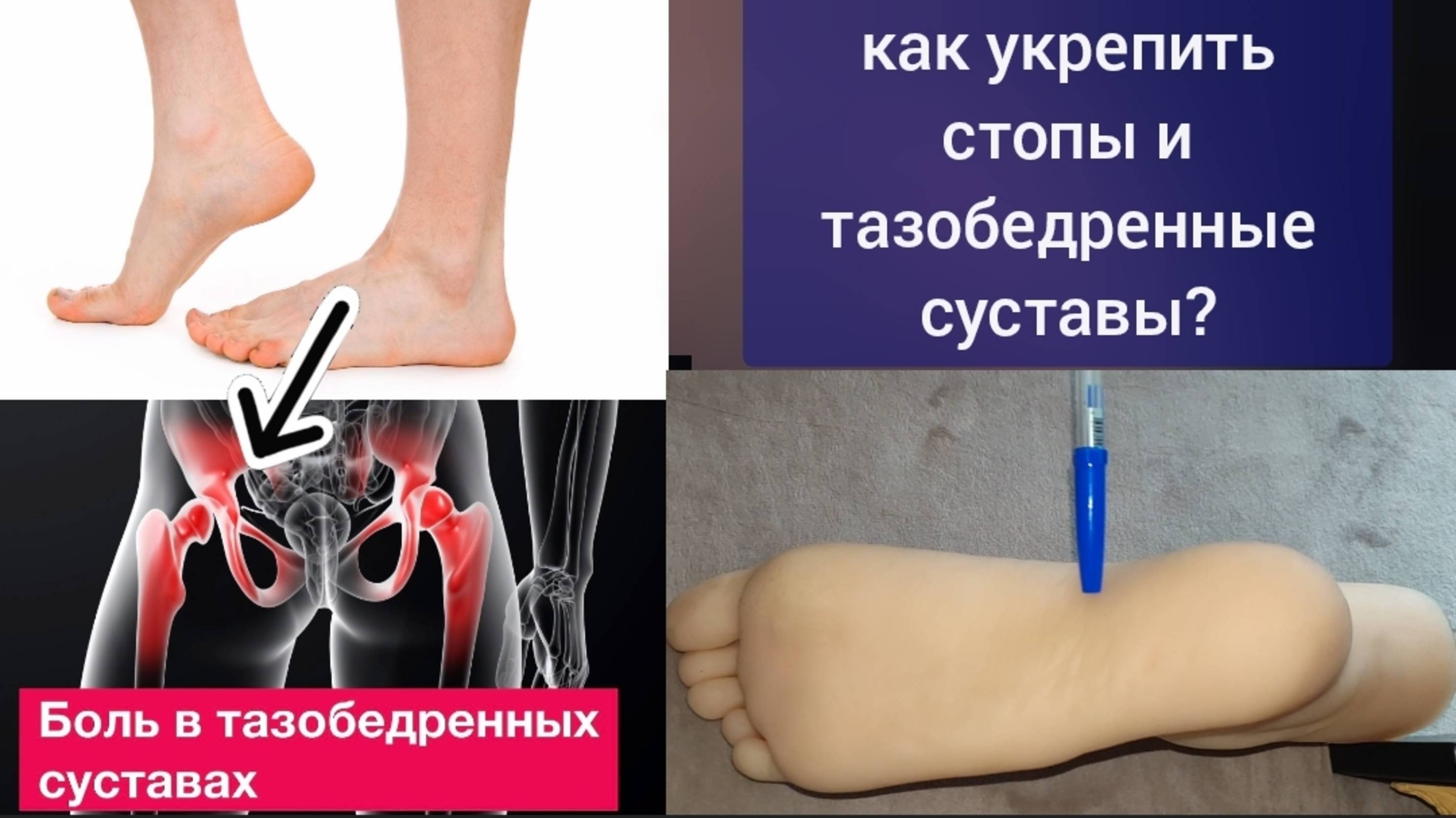 Продольные своды дают жизнь и здоровье стопам и тазобедренным суставам. Как укрепить? Упражнения