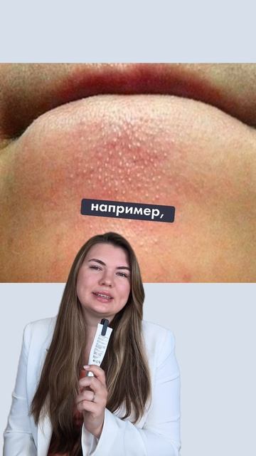 Закупоренные поры