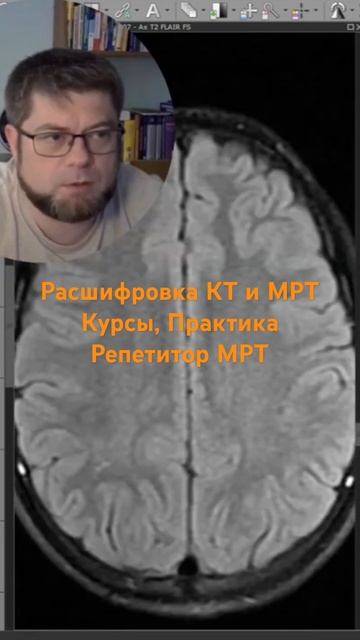 Репетитор МРТ