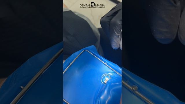 В этом ролике Вячеслав Юрьевич Соколовский расскажет о коффердаме.