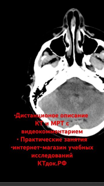 6 марта 2025 г.