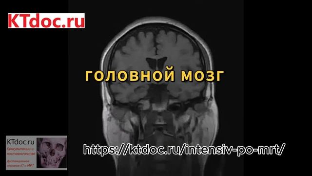 Интенсив по МРТ май