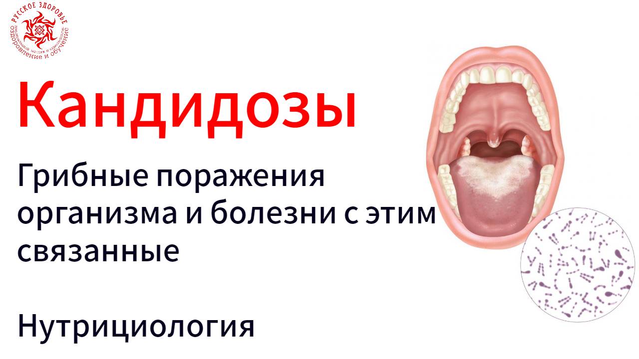 Кандидозы. Грибы и болезни. Веб с экспертом- нутрициологом. Приглашение.
