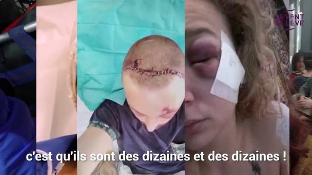 GILETS JAUNES _ LES BLESSÉS QUI DÉRANGENT (convert-video-online.com)