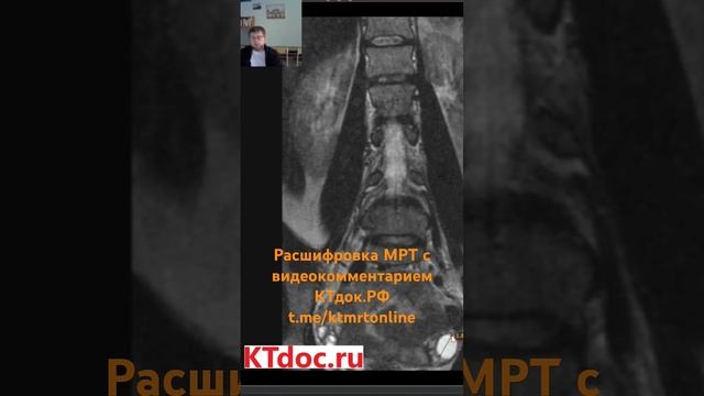 Расшифровка МРТ с видеокомментарием
