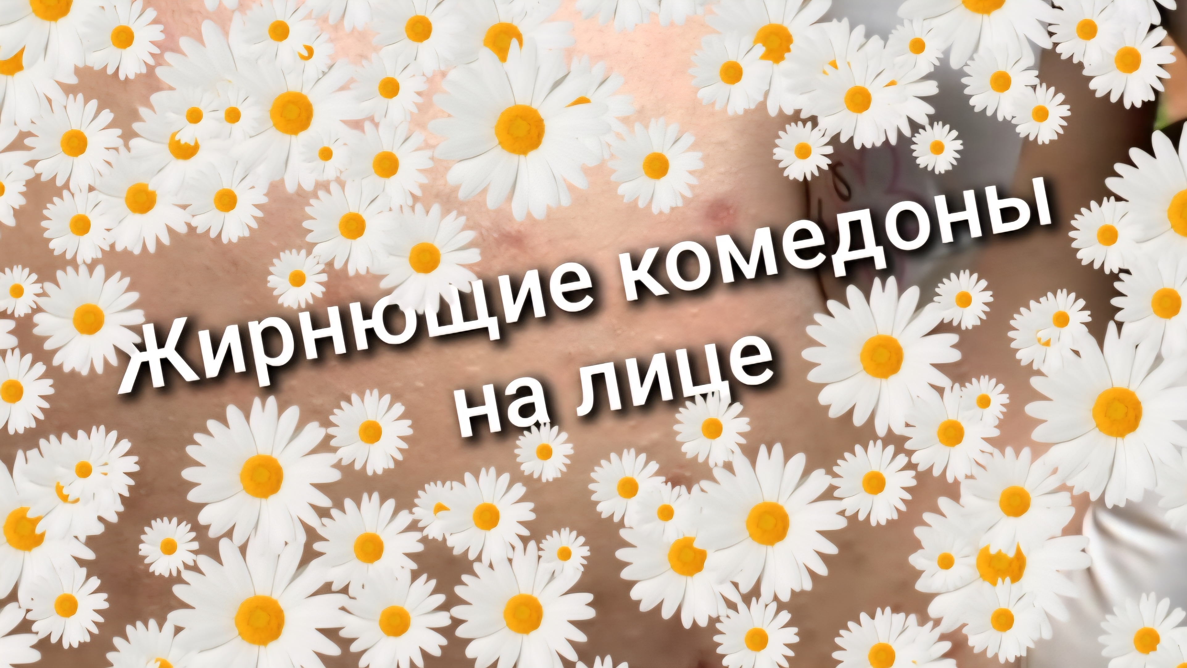 Залипуха