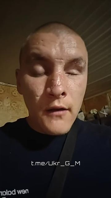 🇺🇦Бывший ВСУшник,получивший тяжёлое ранение, судится с государством, которое не оказало ему помощи